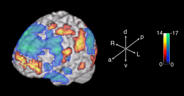 improv fmri